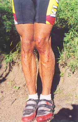 Legs of the Schwartz.